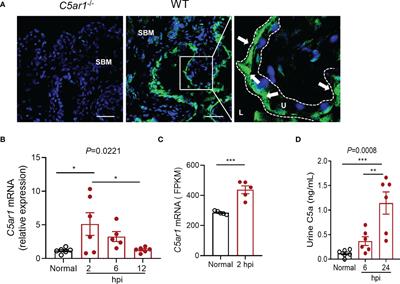 The C5a/C5aR1 Axis Contributes to the Pathogenesis of Acute Cystitis Through Enhancement of Adhesion and Colonization of Uropathogenic E. coli